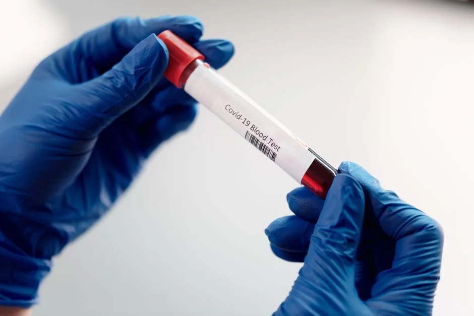 Congo Launches Experimental Ebola Trial as Death Toll Surpasses 500 — Health Medicine